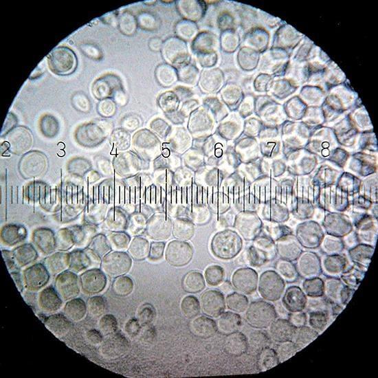 Drożdże w powiększeniu 1500 razy. Fot. Bob Blaylock, CC By-SA Drożdże w powiększeniu 1500 razy. Fot. Bob Blaylock, CC By-SA