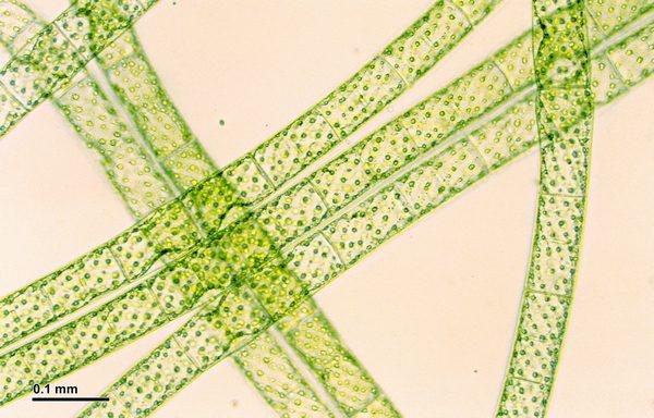 Spirogyra (skrętnice), Fot. Josef Reischig, powiększenie 300x, licencja CC BY-SA Spirogyra (skrętnice)
